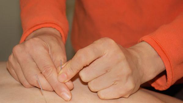 5 Unique Aspects of Japanese Acupuncture: My Lineage