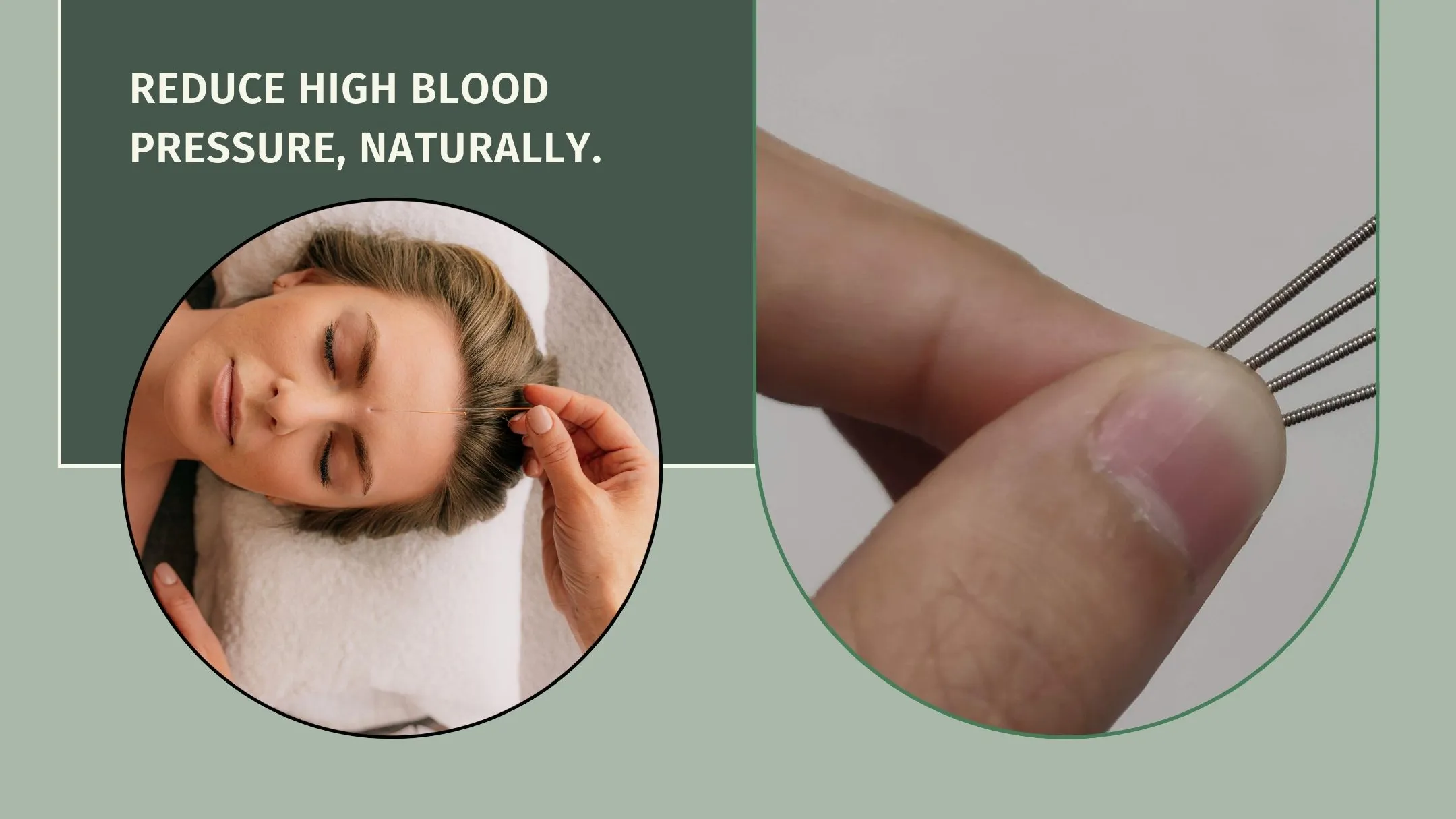 Acupuncture for Hypertension